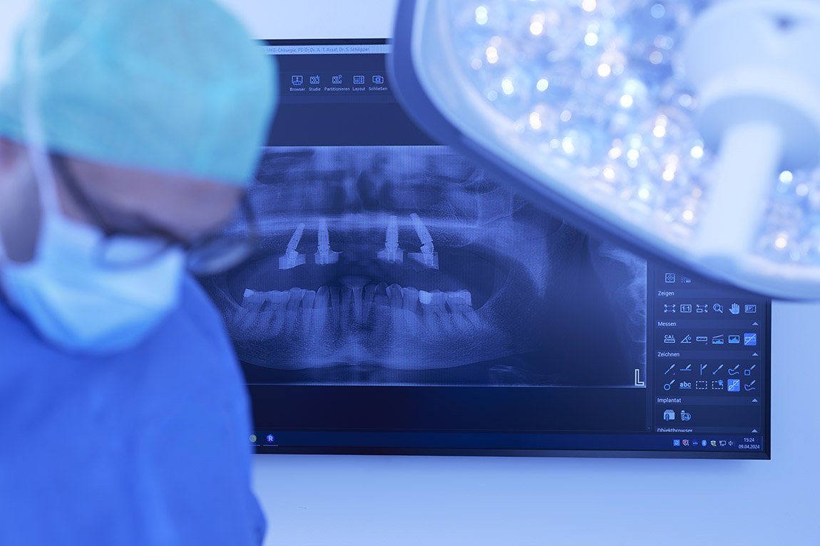 Implantat-OP. Foto: m2c | PRAXISKLINIK ULMENHOF – WITH PASSION FOR SURGERY AND SCIENCE